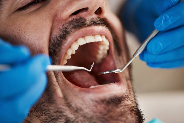 Best Tooth Infection Emergency Dentist  in Seal Beach, CA